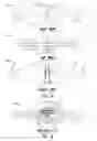 Fig. 06 - Spoke-mounted wheel safety light
