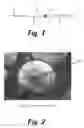 Fig. 02 - Enhanced carriers for the delivery of microparticles to bodily tissues and fluids