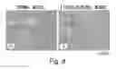 Fig. 09 - FIBROSIS INHIBITOR