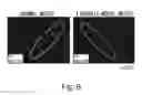 Fig. 10 - FIBROSIS INHIBITOR