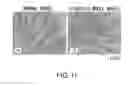 Fig. 12 - FIBROSIS INHIBITOR