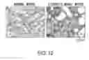 Fig. 13 - FIBROSIS INHIBITOR
