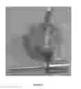Fig. 02 - Biopolymer Based Implantable Degradable Devices