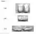 Fig. 02 - CONTROLLED RELEASE COMPOSITION AND PREPARATION THEREOF