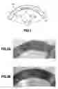 Fig. 02 - Method for making a composite material having at least one twisted thread deposited therein