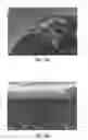 Fig. 07 - Surface treated polycrystalline ceramic orthodontic bracket and method of making same
