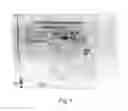 Fig. 02 - Methods for detecting fetal cells in the maternal blood