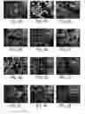 Fig. 03 - Methods for detecting fetal cells in the maternal blood