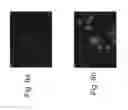 Fig. 07 - Methods for detecting fetal cells in the maternal blood