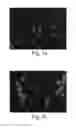 Fig. 08 - Methods for detecting fetal cells in the maternal blood