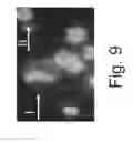 Fig. 10 - Methods for detecting fetal cells in the maternal blood