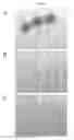 Fig. 02 - METHODS FOR ISOLATING AND USING PITUITARY ADENOMA STEM CELLS AND PITUITARY ADENOMA CELLS