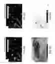 Fig. 08 - Methods and compositions for isolating metastatic cancer cells, and use in measuring metastatic potential of a cancer thereof