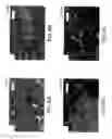 Fig. 09 - Methods and compositions for isolating metastatic cancer cells, and use in measuring metastatic potential of a cancer thereof