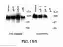 Fig. 30 - Methods and compositions for isolating metastatic cancer cells, and use in measuring metastatic potential of a cancer thereof