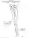 Fig. 10 - Surgical access system and related methods