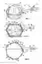 Fig. 02 - ENDOSCOPIC INFLATABLE RETRACTION DEVICE, METHOD OF USING, AND METHOD OF MAKING