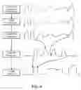 Fig. 09 - Nasal capnographic pressure monitoring system