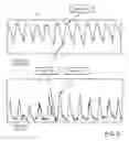 Fig. 16 - Nasal capnographic pressure monitoring system