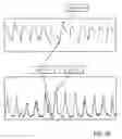 Fig. 17 - Nasal capnographic pressure monitoring system