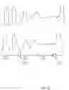 Fig. 19 - Nasal capnographic pressure monitoring system