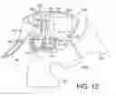 Fig. 13 - Hand held breast pump