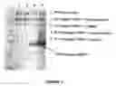 Fig. 02 - Functional expression of higher plant nitrate transporters in Pichia Pastoris