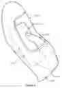 Fig. 10 - Garment Having Work Revealing Window and Method of Use