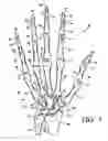 Fig. 02 - Glove