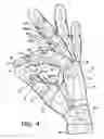 Fig. 07 - Glove
