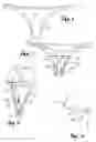 Fig. 02 - Visual privacy garment