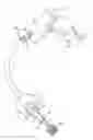 Fig. 01 - Pulmonary occlusal stent delivery catheter, loading system and methods of use