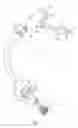 Fig. 02 - Pulmonary occlusal stent delivery catheter, loading system and methods of use
