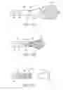 Fig. 17 - Pulmonary occlusal stent delivery catheter, loading system and methods of use