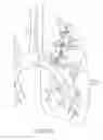 Fig. 19 - Pulmonary occlusal stent delivery catheter, loading system and methods of use