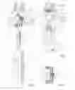 Fig. 02 - Hose system for high pressure hydraulic system