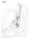 Fig. 08 - Adjustable work platform for pipe and casing stabbing operations