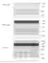 Fig. 07 - Nonvolatile memory cell including carbon storage element formed on a silicide layer