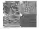 Fig. 01 - DISC AUGMENTATION WITH HYALURONIC ACID