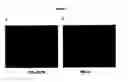Fig. 04 - Periodic acid-schiff staining with detection in the infrared range