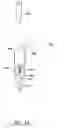 Fig. 11 - SYSTEM, APPARATUS AND METHOD FOR MATERIAL PREPARATION AND/OR HANDLING