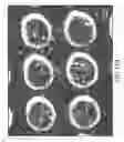 Fig. 41 - CELL PATTERN AND METHOD FOR PRODUCING THE SAME