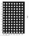 Fig. 02 - Immunologic assay for detection of autoantibodies to folate binding protein