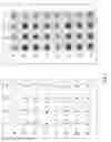 Fig. 04 - Immunologic assay for detection of autoantibodies to folate binding protein