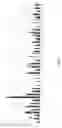 Fig. 07 - Immunologic assay for detection of autoantibodies to folate binding protein