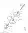 Fig. 04 - Device and Method for Measuring a Physical Parameter in an Anatomic Organ