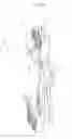 Fig. 49 - Universal catheter securement device