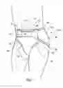 Fig. 02 - Outer Cover for Two-Piece Wearable Absorbent Article