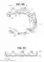 Fig. 04 - Craniotomy closures and plugs