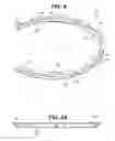 Fig. 07 - Craniotomy closures and plugs